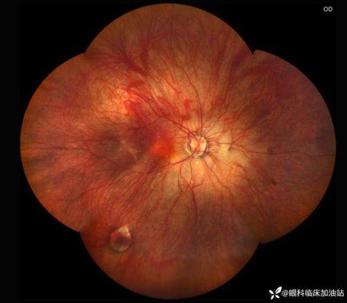 武汉中医和西医结合骨科医院眼科收费价格表/收费标准