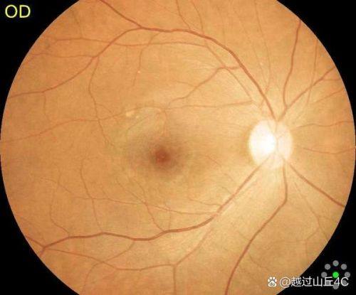 武汉中医和西医结合骨科医院眼科是正规医院吗？