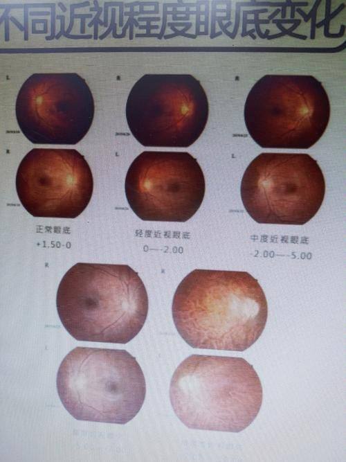 武汉中医和西医结合骨科医院眼科详细的预约挂号方式及流程