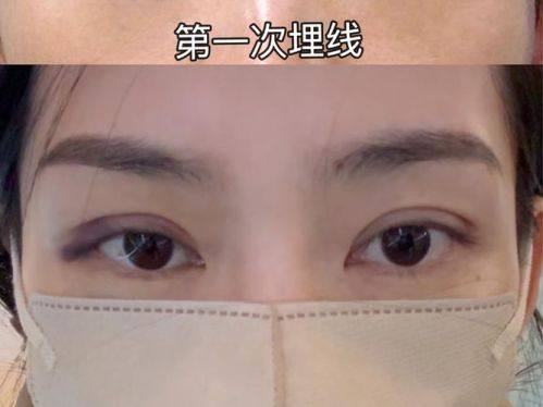 北京凯润婷医疗美容医院是正规医院吗？