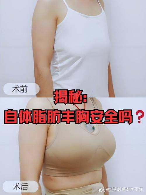 厦门银河整形医院是正规医院吗？