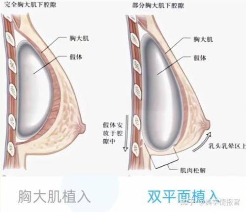 厦门银河整形医院医生团队实力强大及骨干医生简介