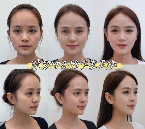 宁波北仑美塑名妍整形医院是正规医院吗？