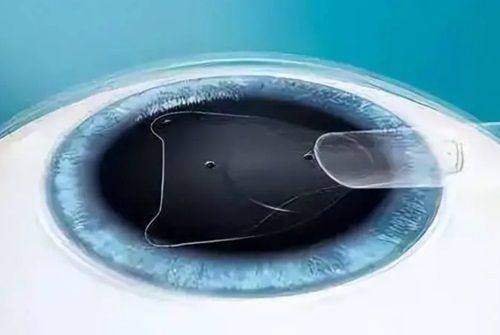 保山腾冲兆西眼科真人口碑评价怎么样？