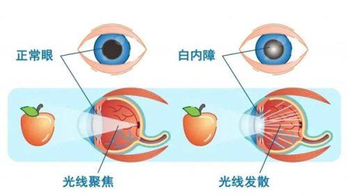 新医 大一附院眼科是正规医院吗？