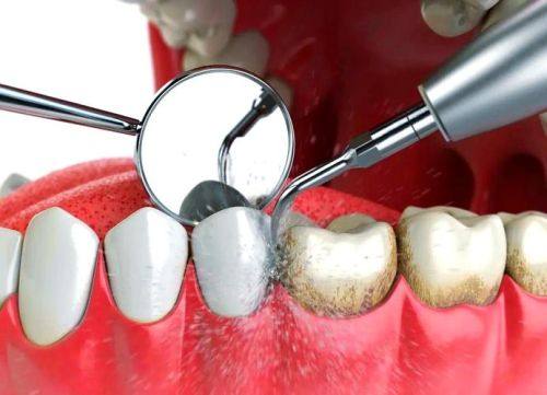 浙江湖州丁建红牙科诊所收费价格表/收费标准