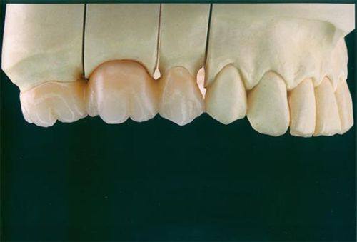 韶关市壹心口腔收费价格表/收费标准
