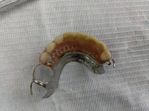 浙江湖州丁建红牙科诊所真人口碑评价怎么样？