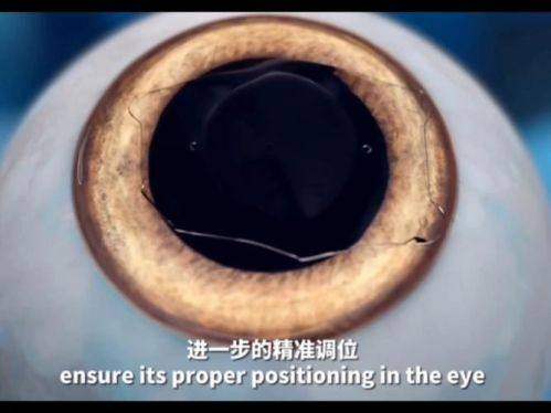 保山腾冲兆西眼科地址电话营业时间