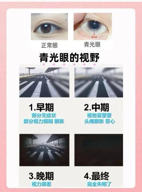 新医 大一附院眼科真人口碑评价怎么样？