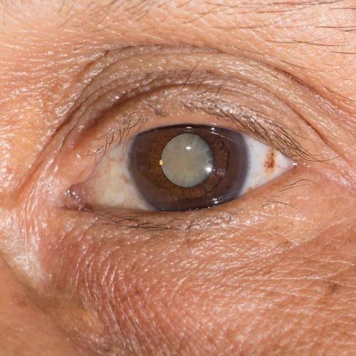 新医 大一附院眼科特色项目及技术优势