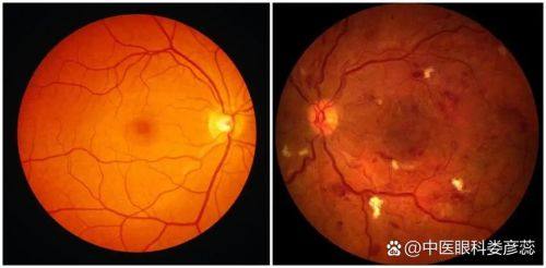 新医 大一附院眼科医生团队实力强大及骨干医生简介