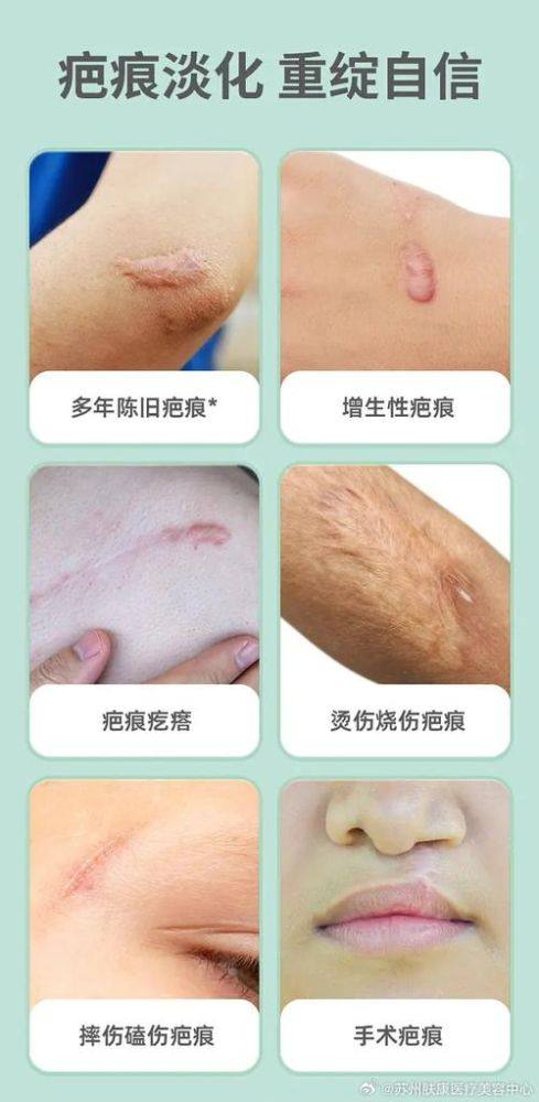 安徽肥西县官亭中 心卫生院整形科收费价格表/收费标准