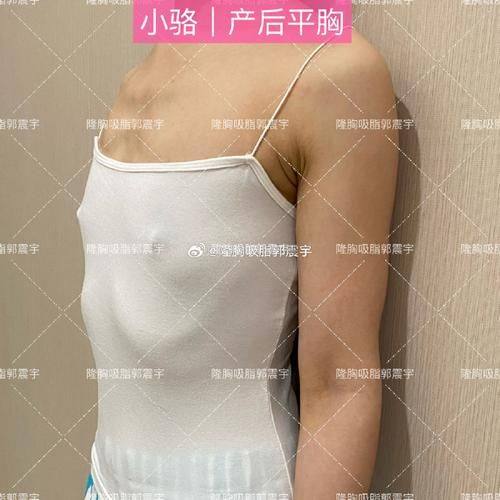 韩国WUNE整形外科收费价格表/收费标准