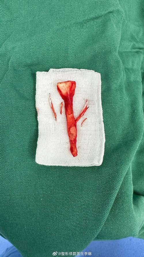 重庆市黔江民族医院皮肤医学整形美容科特色项目及技术优势