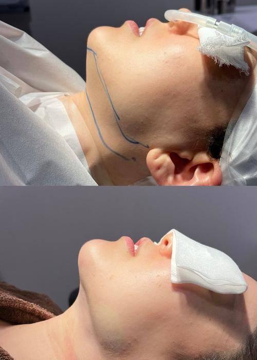 武汉至美整形美容医院真人口碑评价怎么样？