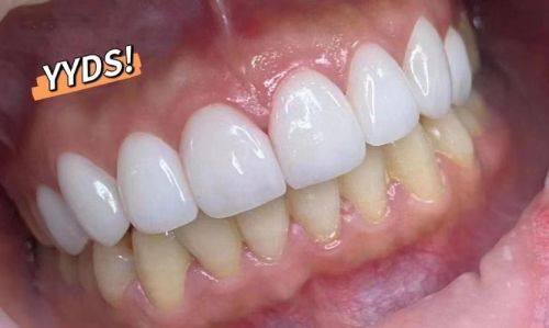 西安拜博口腔（未央大明宫店）真人口碑评价怎么样？