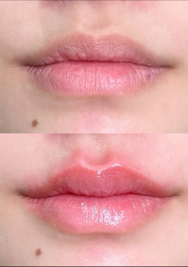 安徽肥西县官亭中 心卫生院整形科真人口碑评价怎么样？