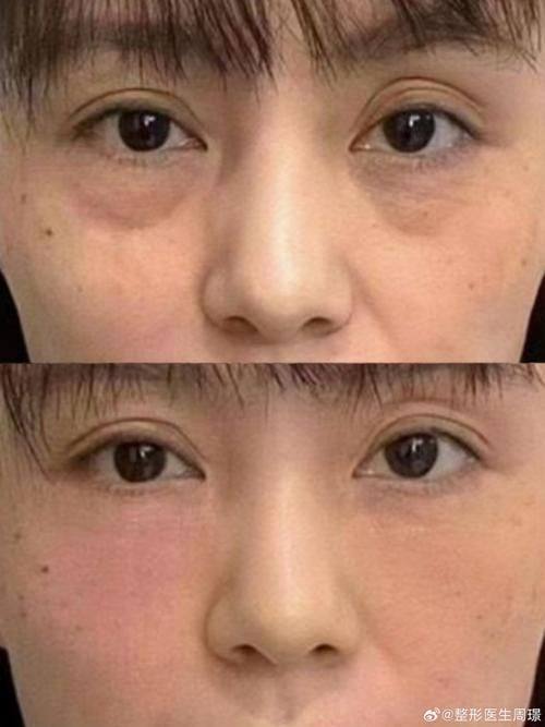 南宁脂美人医疗美容医院地址电话营业时间