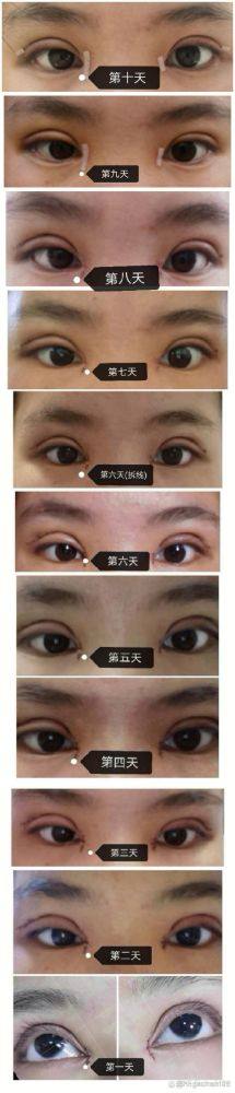 南宁脂美人医疗美容医院是正规医院吗？