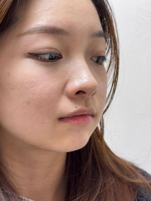 南宁脂美人医疗美容医院收费价格表/收费标准