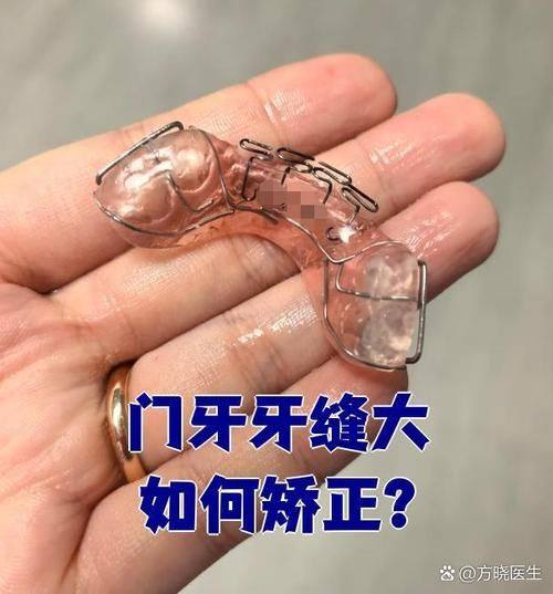 医院真人口碑评价怎么样？