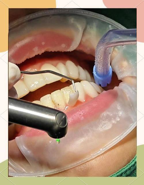 大连百悦口腔诊所真人口碑评价怎么样？