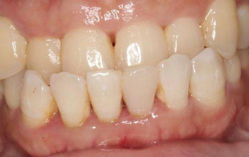 大连百悦口腔诊所特色项目及技术优势