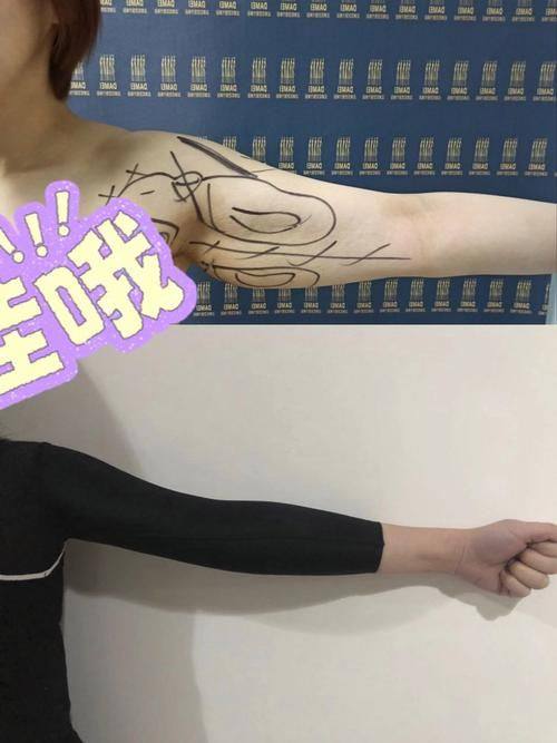 南宁脂美人医疗美容医院医生团队实力强大及骨干医生简介