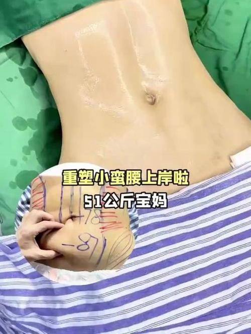 大连刘崴医疗美容机构真人口碑评价怎么样？