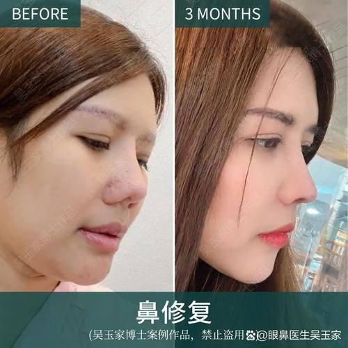 宝鸡高新人民医院整形美容外科医生团队实力强大及骨干医生简介