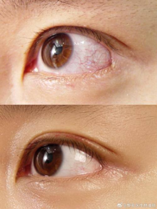 南宁脂美人医疗美容医院详细的预约挂号方式及流程