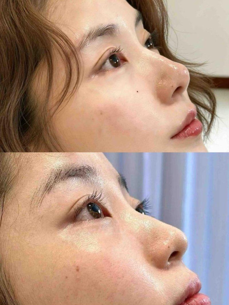 宝鸡高新人民医院整形美容外科是正规医院吗？