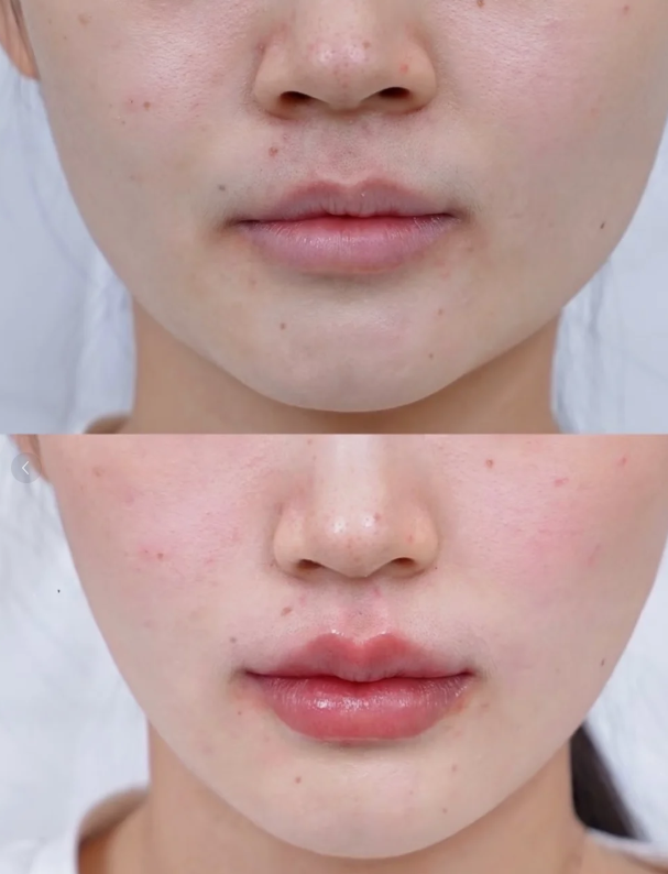 西安医学校附属宝鸡医院详细的预约挂号方式及流程