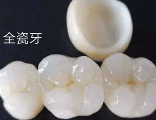 福建医 科 大学附属口腔医院口腔种植科医生团队实力强大及骨干医生简介