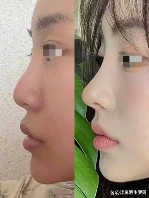 洛阳协和医院整形中 心医生团队实力强大及骨干医生简介