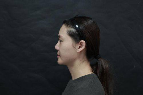 洛阳协和医院整形中 心真人口碑评价怎么样？