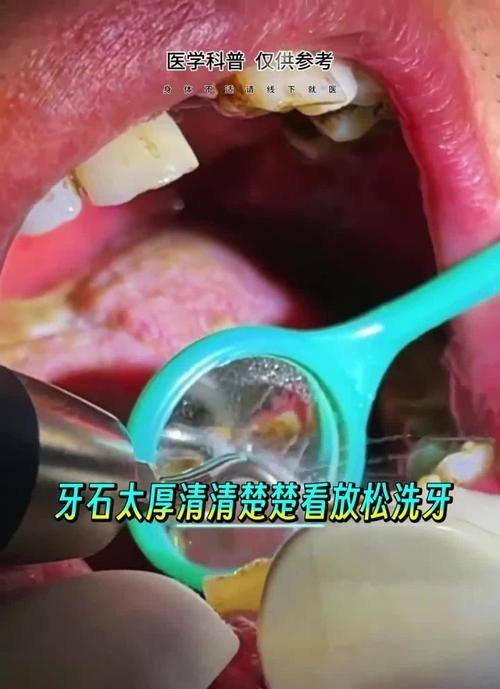 福建医 科 大学附属口腔医院口腔种植科真人口碑评价怎么样？