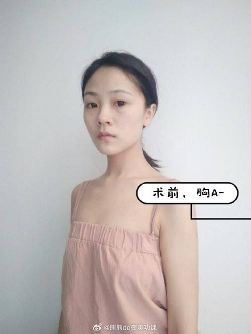 长沙市丽莎医学美容门诊部真人口碑评价怎么样？
