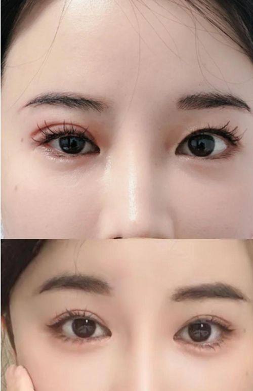 洛阳协和医院整形中 心收费价格表/收费标准