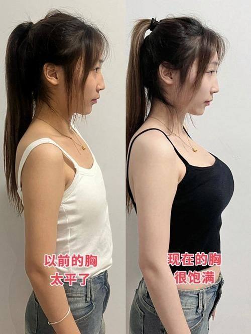 上海翡立思医疗整形美容门诊部真人口碑评价怎么样？