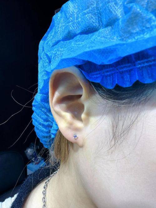 洛阳协和医院整形中 心是正规医院吗？