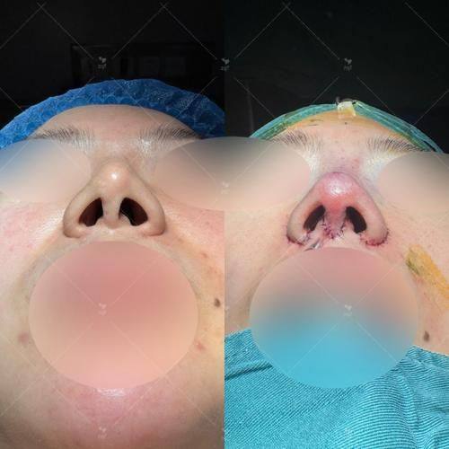 北京医院整形激光美容科特色项目及技术优势