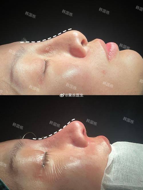 北京医院整形激光美容科是正规医院吗？