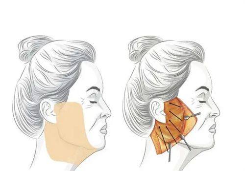 广州华一（原唯臻）医疗美容门诊部详细的预约挂号方式及流程