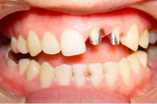 溧阳诺德口腔诊所特色项目及技术优势