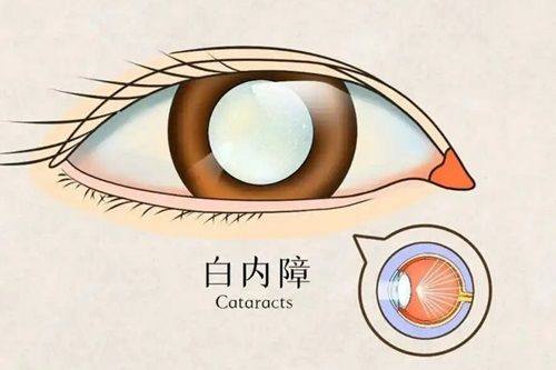 深圳市蛇口人民医院眼科医生团队实力强大及骨干医生简介