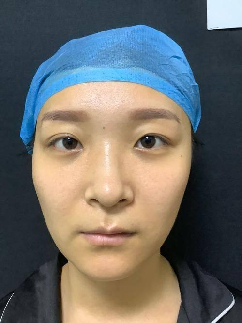 广州华一（原唯臻）医疗美容门诊部收费价格表/收费标准