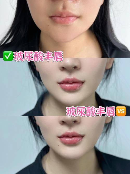 沈阳睿漾整形医院收费价格表/收费标准