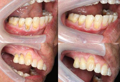 溧阳诺德口腔诊所是正规医院吗？